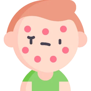 Atopisk dermatitis